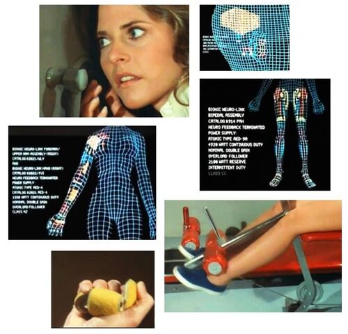 File:Bionic operation Jaime.jpg