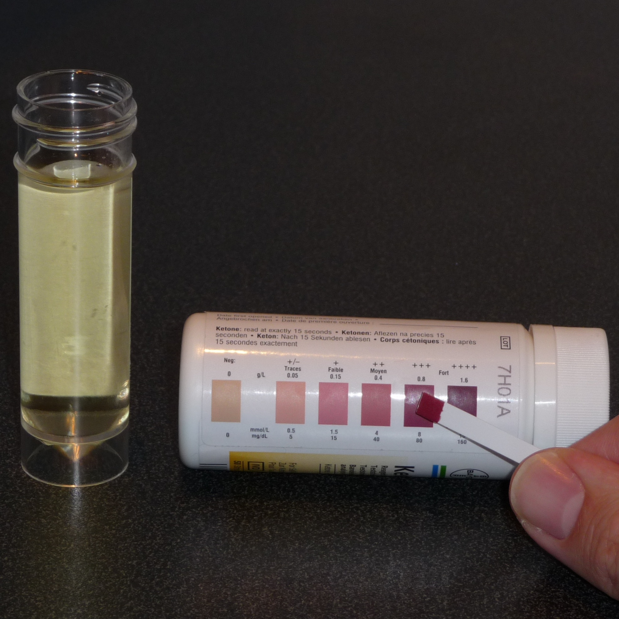 How do urinalysis test strips work?