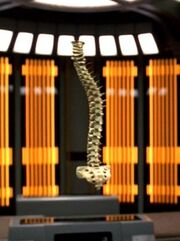 Hologramm einer verkrümmten Wirbelsäule