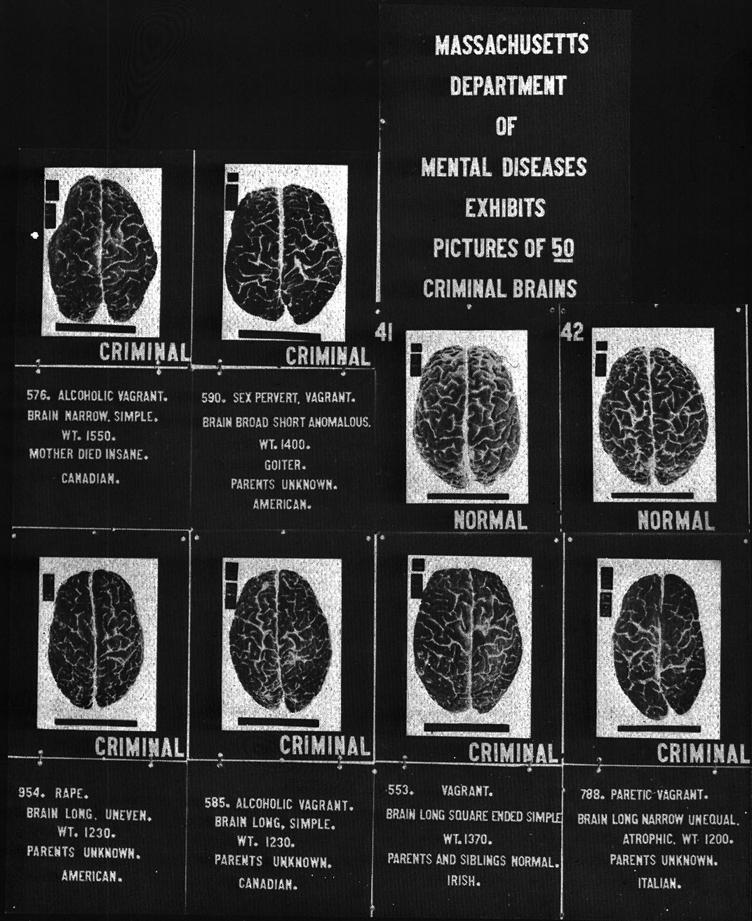 Biological Determinism Psychology Wiki Fandom Powered