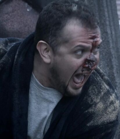 File:9x07 Injured civilian.jpg