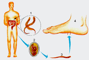 Ancilostomose.jpg