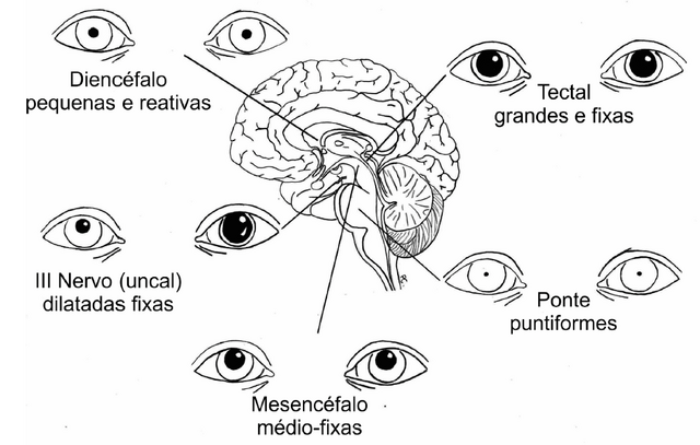 Arquivo:Neuro9.png