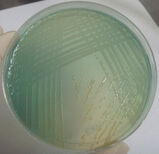 Blofpigmento-verde-difusc3advel-de-pseudomonas-aeruginosa