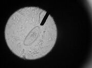 Enterobiase-7.jpg