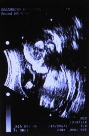 Baby lucy