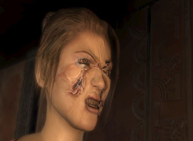 File:Humanzanna3.jpg