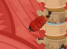 Fire maggot example 2