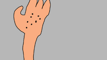 Hand ants
