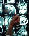 Thumbnail for version as of 15:10, September 6, 2010
