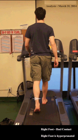 File:Treadmill Analysis PCFD.gif