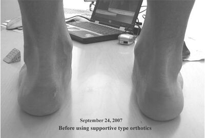 Pre Arch Support