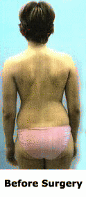 Case Study 2 Pre vs Post Surgery