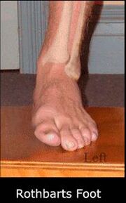 Rothbarts Foot in NP