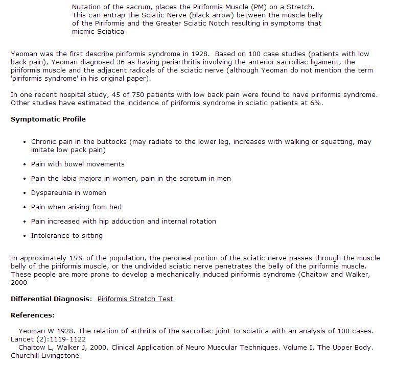 Piriformis Syndrome Info