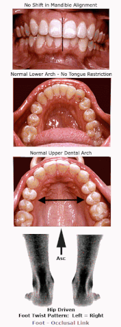 File:Rothbarts Dental Model Animation.gif