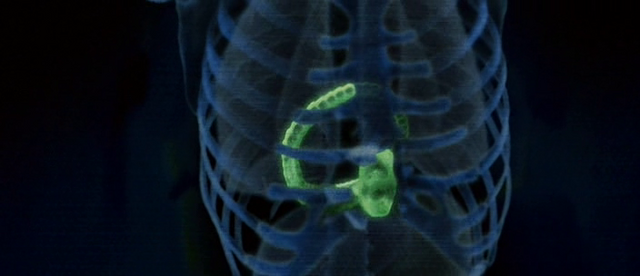 File:Chestburster X-ray (2).png