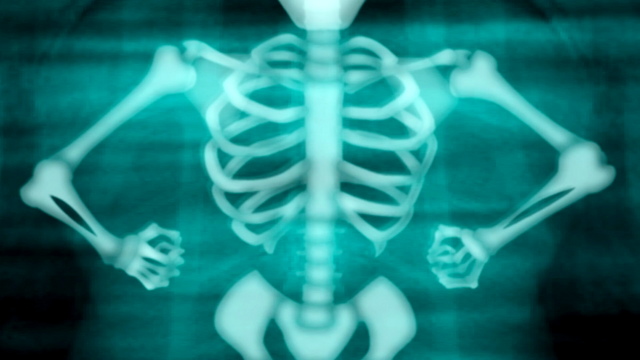 File:ATG (315).png