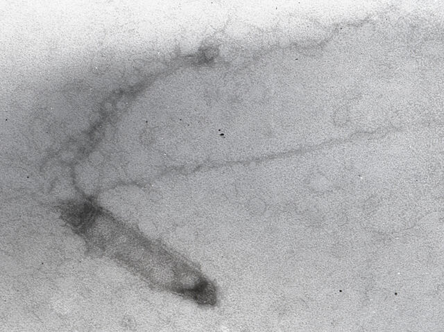 Arquivo:Agcapsid A&D.jpg
