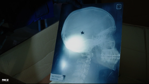 X-Ray Radik