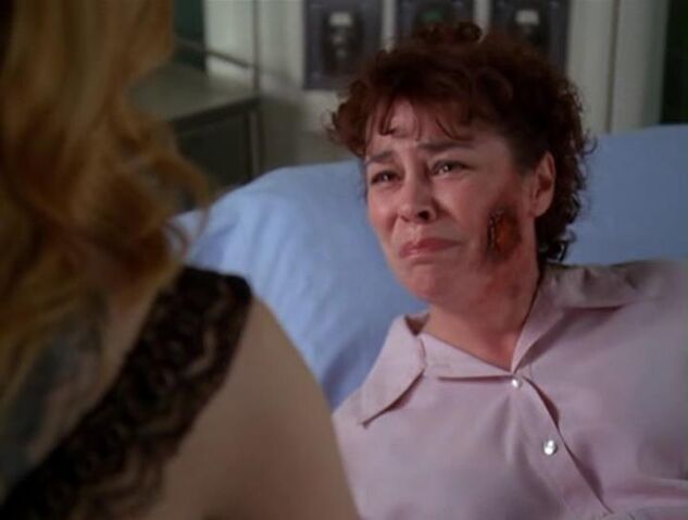 File:Burned-woman.jpg