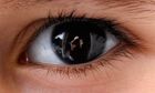 Eye
