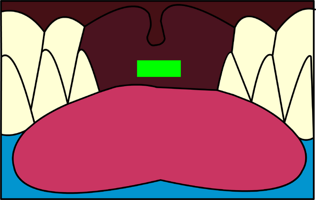 File:Whale's Mouth igloo icon.png