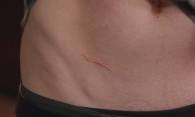 File:S04E05-Jeff's scar.jpg