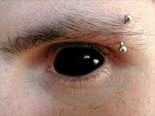 Black-eye