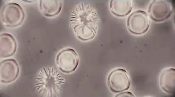 Spore-or-thing