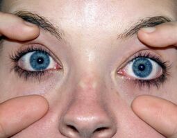 Eyes-Wide-Open