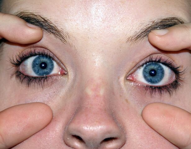 File:Eyes-Wide-Open.jpg