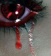 Bloody Eye