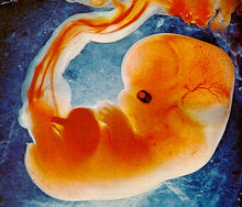 Fetus