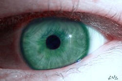 My teal eye