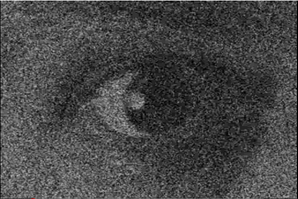 Theeye