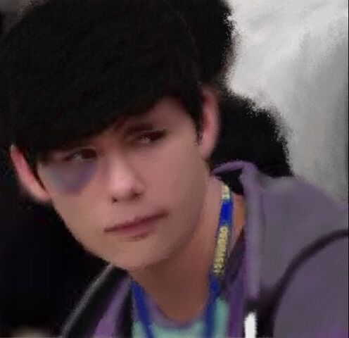 File:Zig Black Eye.jpg