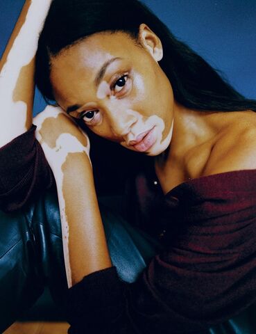 File:Winnie Harlow.jpg