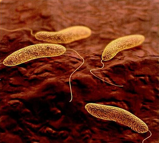 File:Vibrio cholerae DEADLY.png