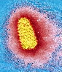 File:Rabies virus.png