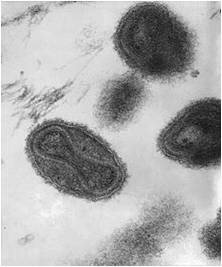File:Smallpox picture.jpg