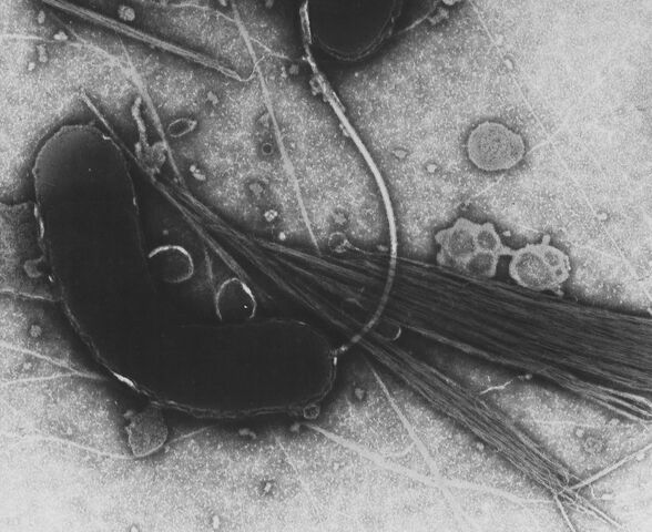 File:Vibrio cholerae (1).jpg