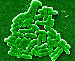 File:E coli bacterium.jpg