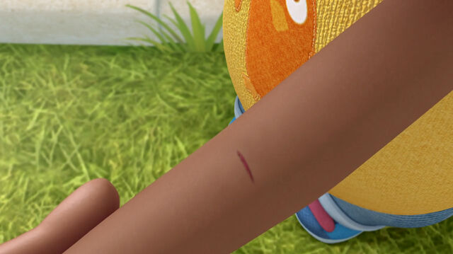 File:Donny's pricked arm.jpg