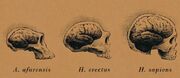 BrainSize