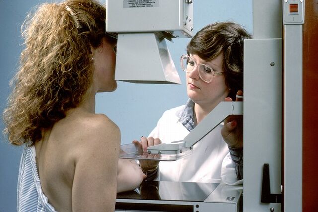 Archivo:Mammogram.jpg