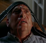 Electrodes brain