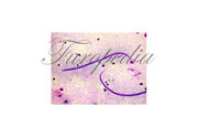 Filaria