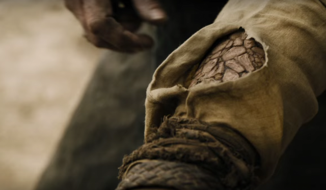 File:Jorah's greyscale s6.png