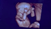 Georgieultrasound730-1